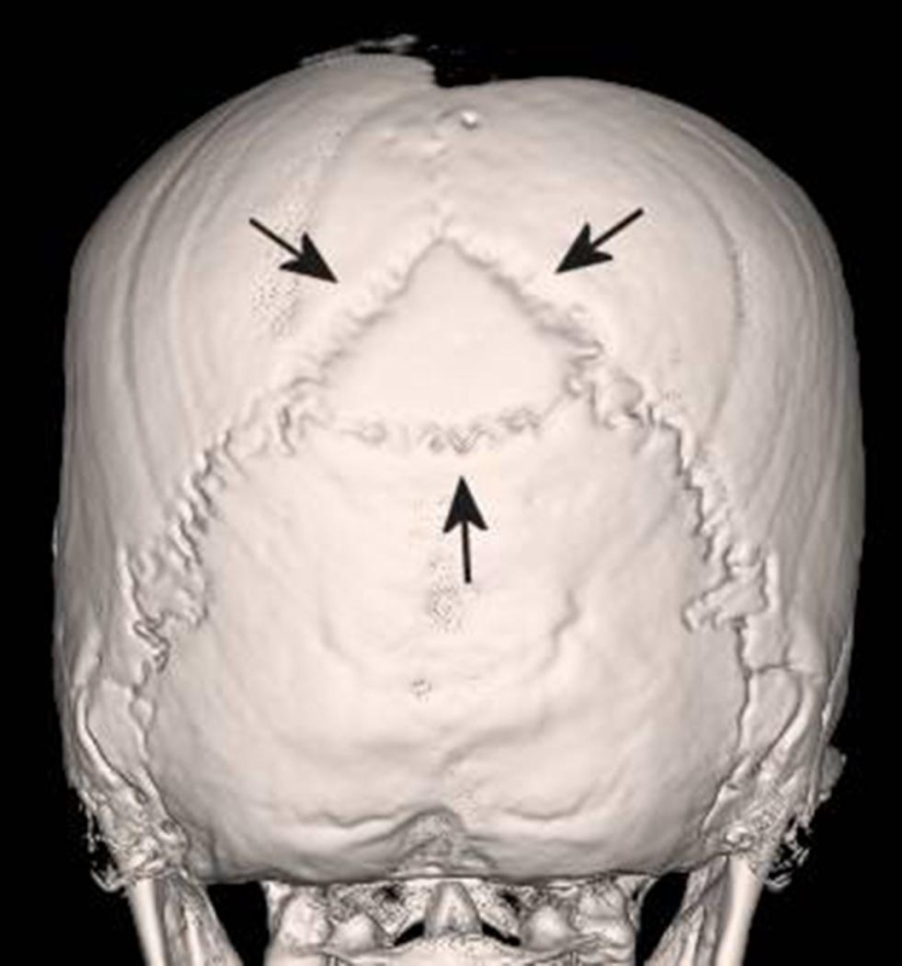 Inca mummies of sacrificed children and women