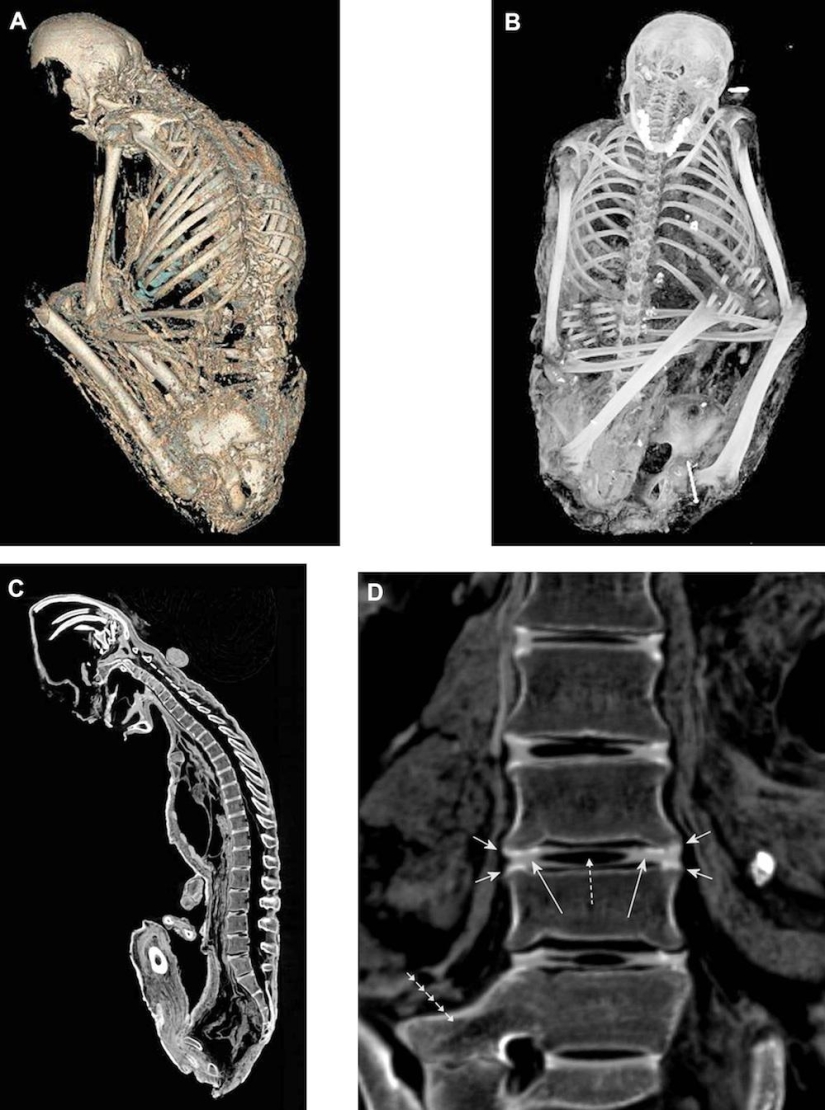 Inca mummies of sacrificed children and women