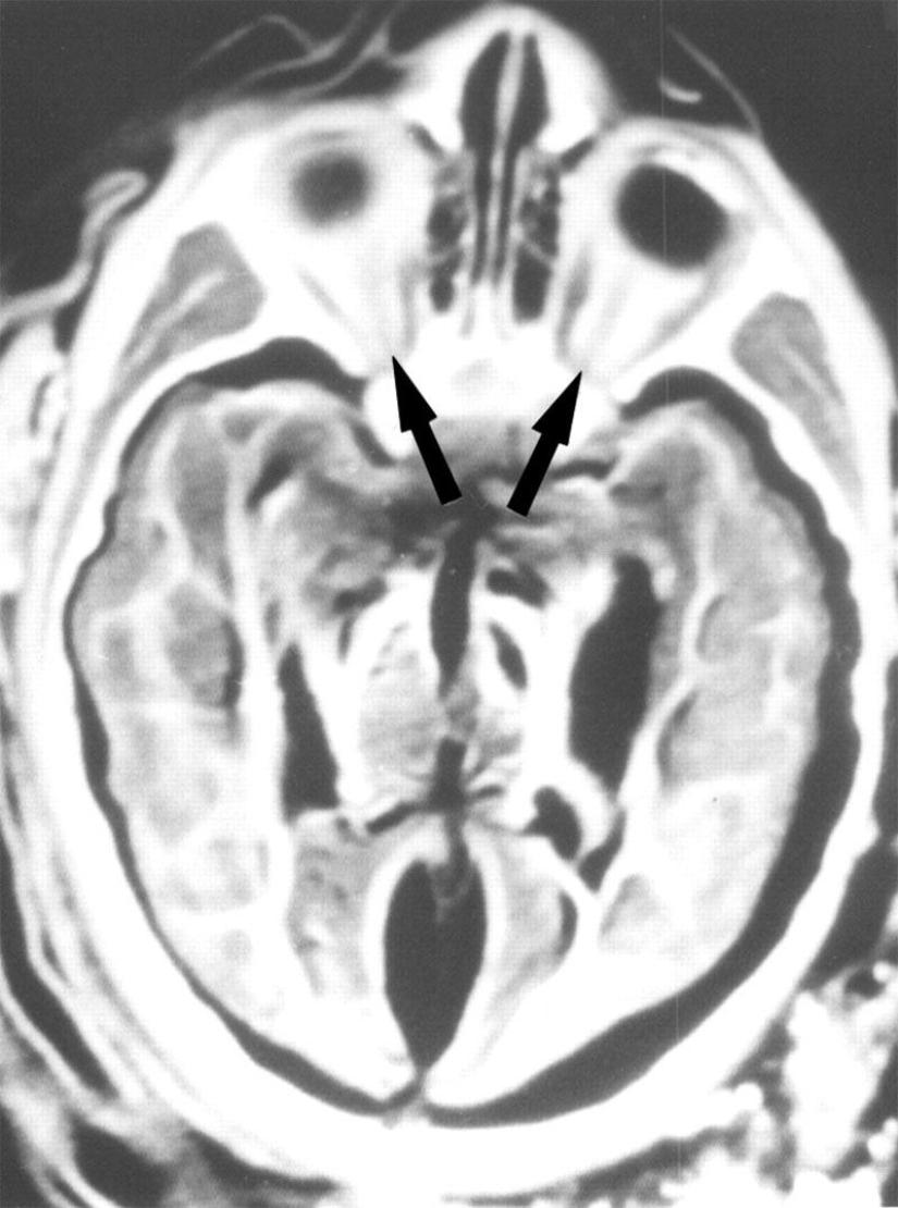 Inca mummies of sacrificed children and women