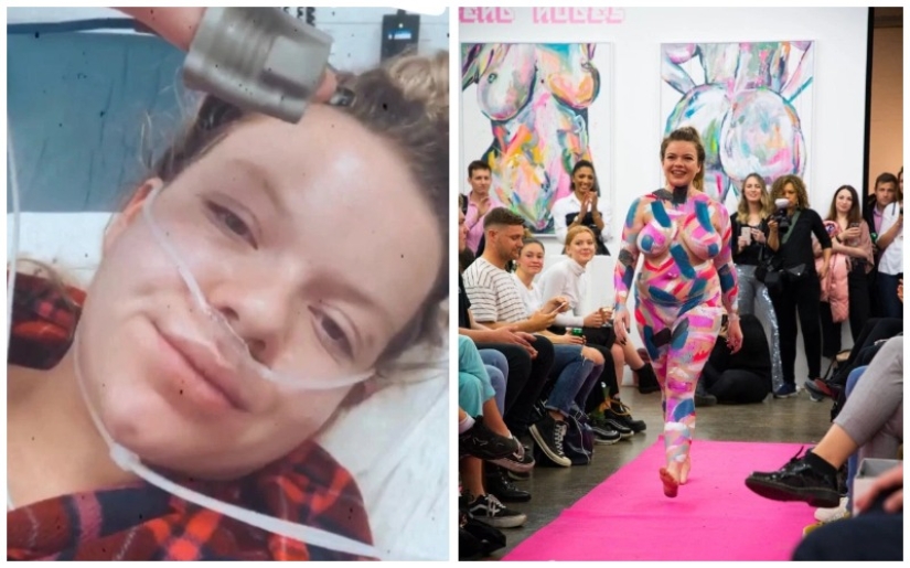 Insight un paso antes de la muerte: cómo la enfermedad le dio a la niña confianza en sí misma y amor por su propio cuerpo