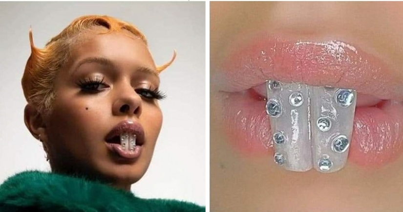 Is it fashionable? I give you a tooth! How outrageous fashion crept into dentistry Is it fashionable? I give you a tooth! How outrageous fashion crept into dentistry
