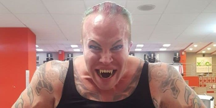 Is it fashionable? I give you a tooth! How outrageous fashion crept into dentistry Is it fashionable? I give you a tooth! How outrageous fashion crept into dentistry