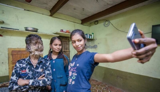 Kind and fluffy: A 13-year-old boy from India suffers from "werewolf syndrome"