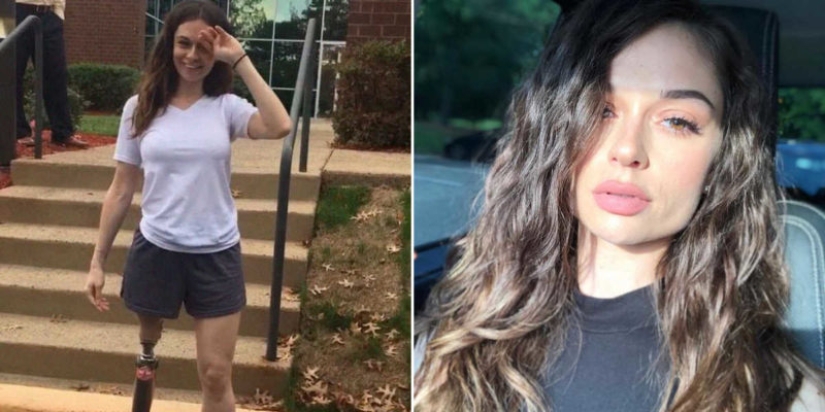 "La amputación ya es mejor": una niña perdió una pierna a los 11 años, se convirtió en modelo y ahora inspira a otros