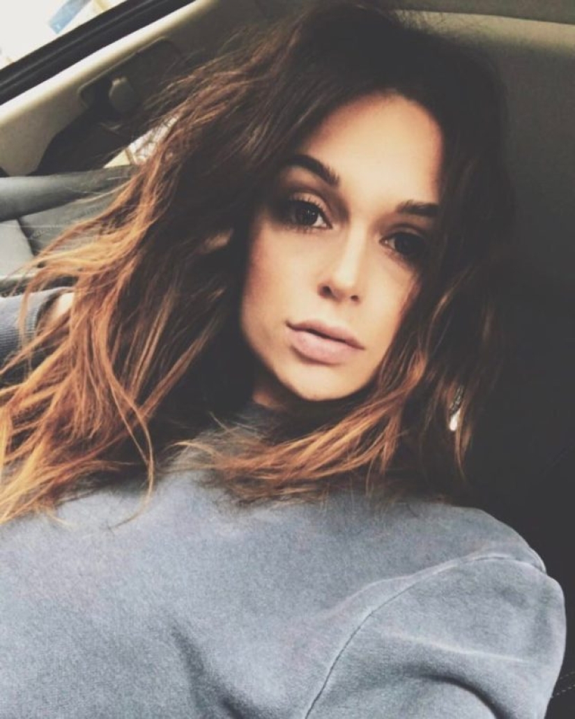 "La amputación ya es mejor": una niña perdió una pierna a los 11 años, se convirtió en modelo y ahora inspira a otros