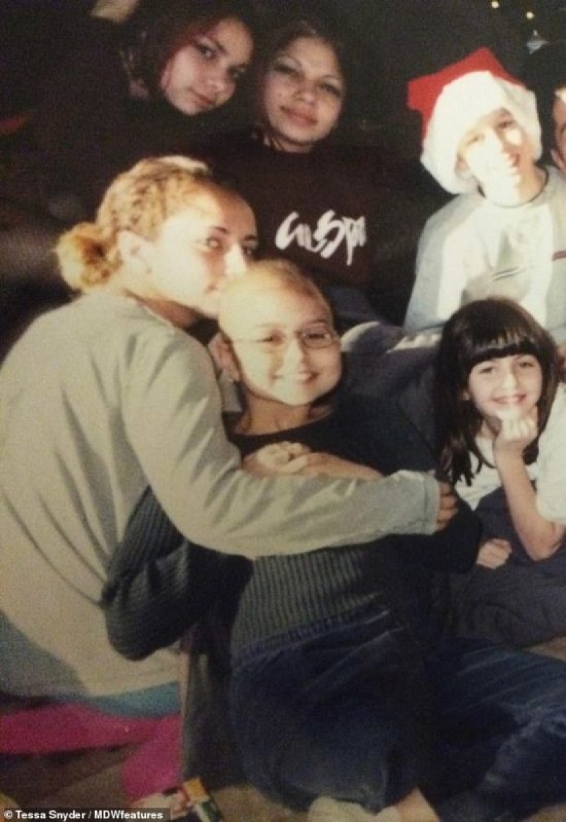 "La amputación ya es mejor": una niña perdió una pierna a los 11 años, se convirtió en modelo y ahora inspira a otros