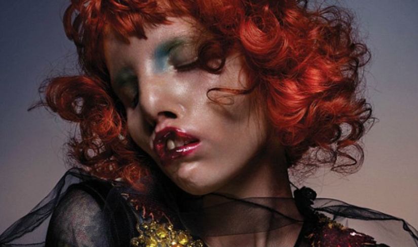 La belleza no es para todos: una modelo con síndrome de ojo de gato La belleza no es para todos: una modelo con síndrome de ojo de gato