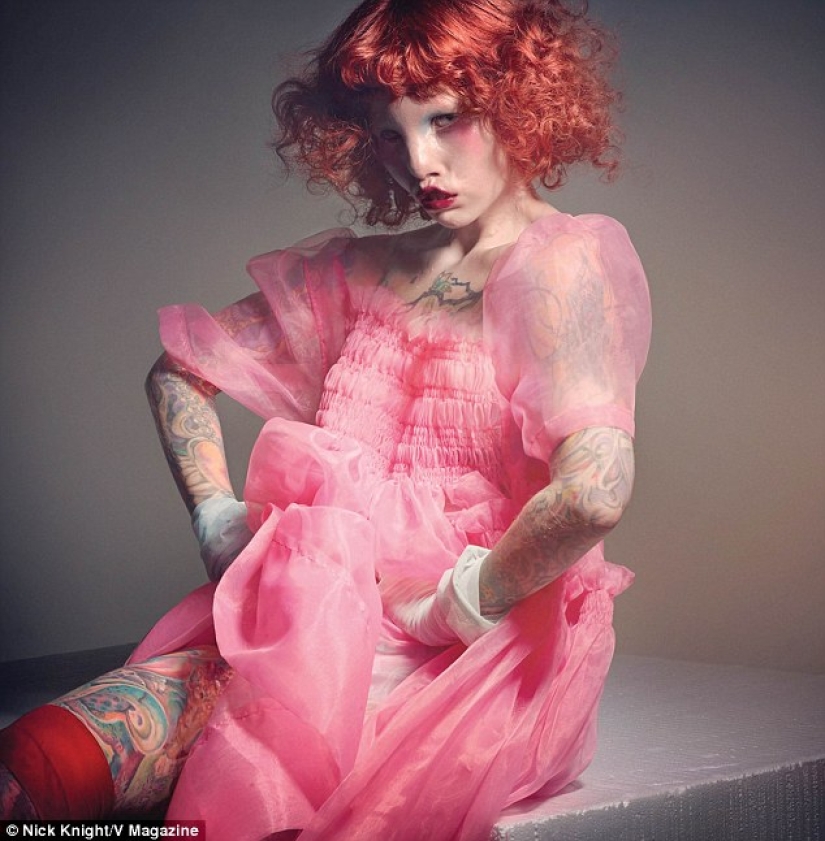 La belleza no es para todos: una modelo con síndrome de ojo de gato La belleza no es para todos: una modelo con síndrome de ojo de gato