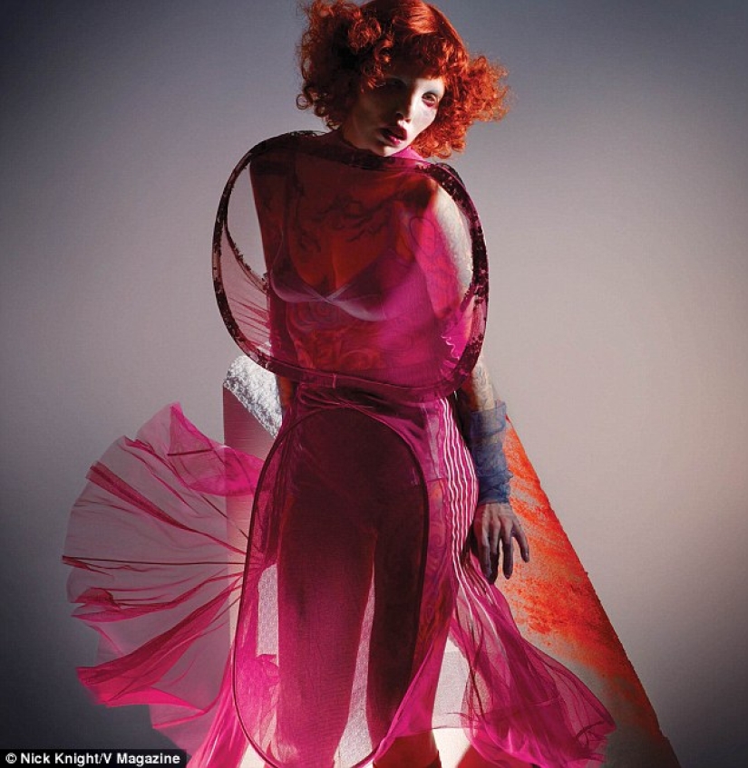 La belleza no es para todos: una modelo con síndrome de ojo de gato La belleza no es para todos: una modelo con síndrome de ojo de gato