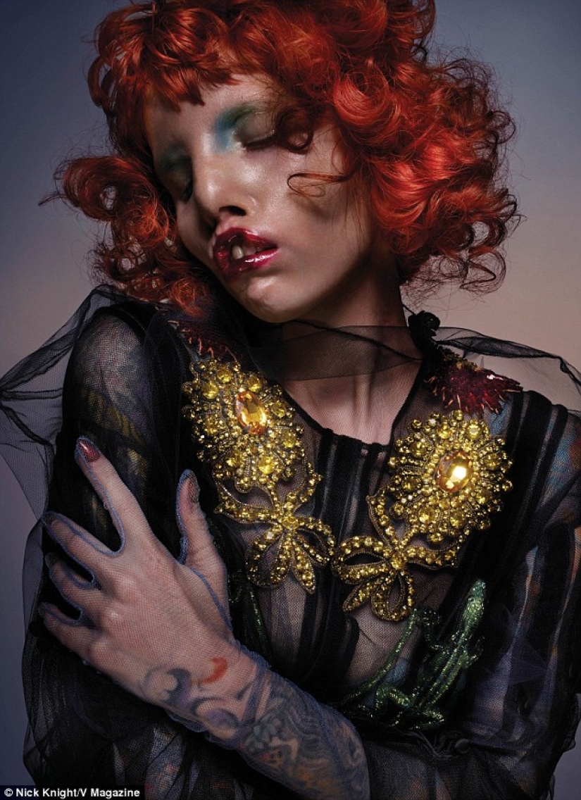 La belleza no es para todos: una modelo con síndrome de ojo de gato La belleza no es para todos: una modelo con síndrome de ojo de gato