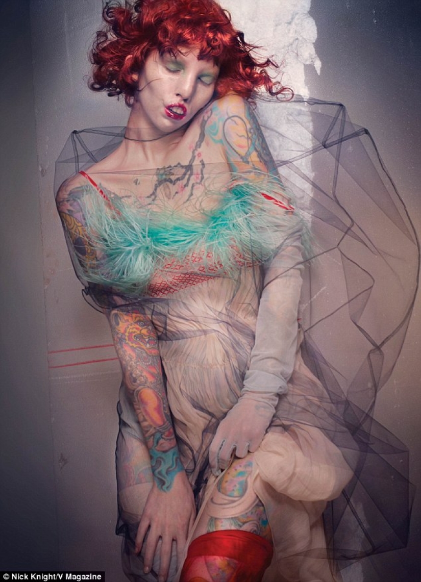 La belleza no es para todos: una modelo con síndrome de ojo de gato La belleza no es para todos: una modelo con síndrome de ojo de gato