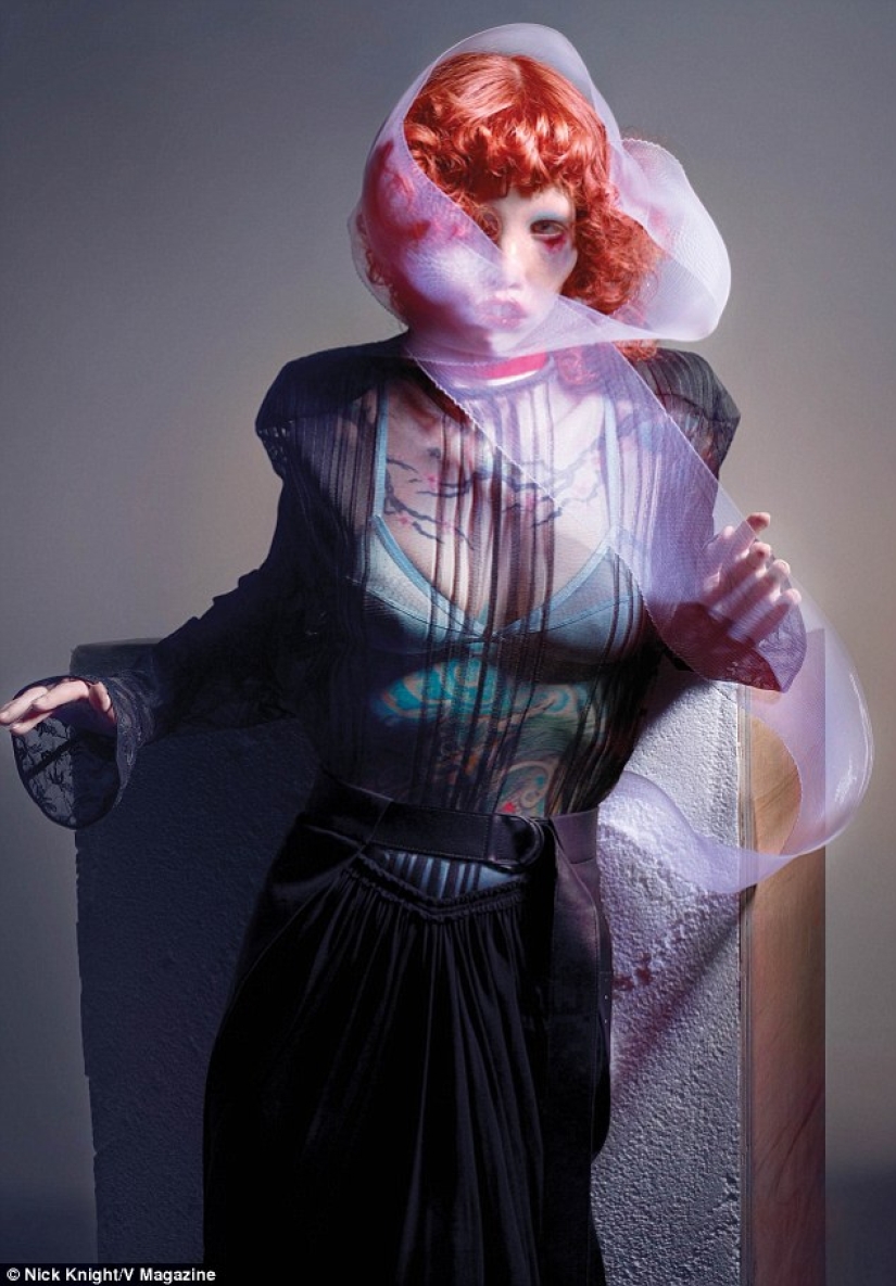 La belleza no es para todos: una modelo con síndrome de ojo de gato La belleza no es para todos: una modelo con síndrome de ojo de gato