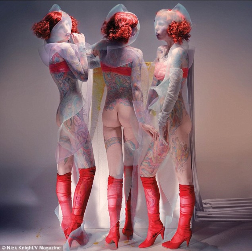 La belleza no es para todos: una modelo con síndrome de ojo de gato La belleza no es para todos: una modelo con síndrome de ojo de gato