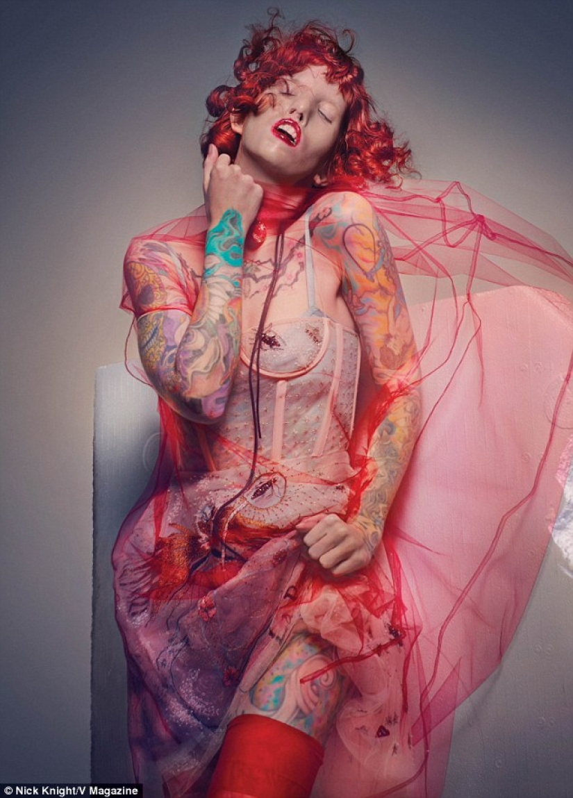 La belleza no es para todos: una modelo con síndrome de ojo de gato La belleza no es para todos: una modelo con síndrome de ojo de gato