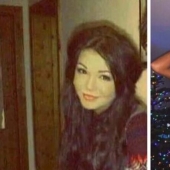 La chica, obsesionada con el bronceado, se convirtió en una de piel oscura. Todo gracias al solarium y las inyecciones