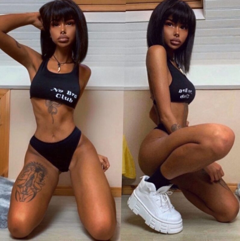 La chica, obsesionada con el bronceado, se convirtió en una de piel oscura. Todo gracias al solarium y las inyecciones La chica, obsesionada con el bronceado, se convirtió en una de piel oscura. Todo gracias al solarium y las inyecciones