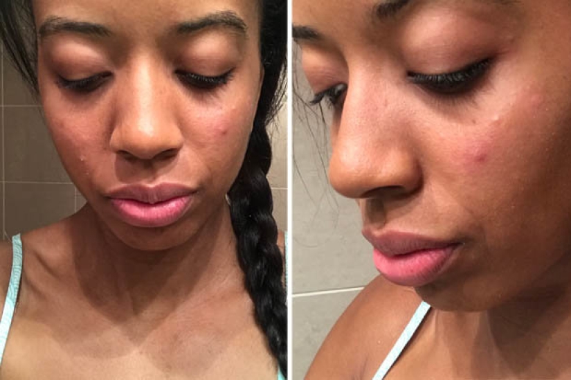 La historia de cuatro fitonyashek que se sentaron en una "dieta de hamburguesas" y casi se volvieron locos La historia de cuatro fitonyashek que se sentaron en una "dieta de hamburguesas" y casi se volvieron locos