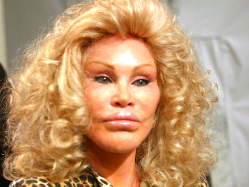 La loca vida de la multimillonaria Jocelyn Wildenstein, conocida como "Catwoman"
