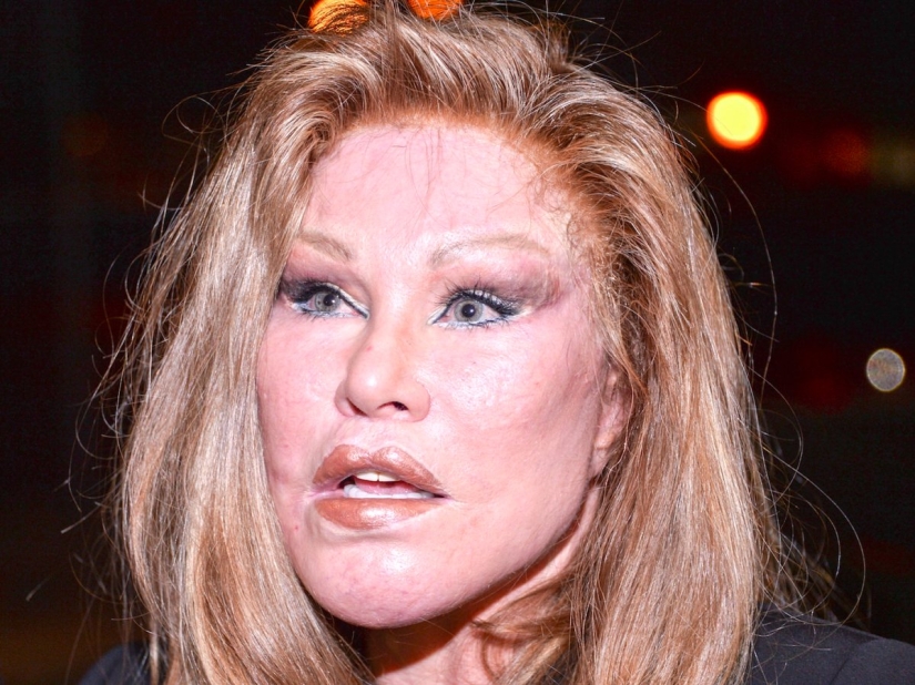 La loca vida de la multimillonaria Jocelyn Wildenstein, conocida como "Catwoman"