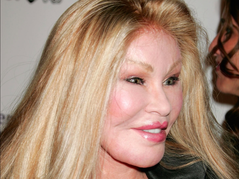 La loca vida de la multimillonaria Jocelyn Wildenstein, conocida como "Catwoman"