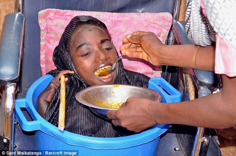 La niña de la cuenca: la historia de una mujer nigeriana con la cabeza de una mujer adulta y el cuerpo de un bebé