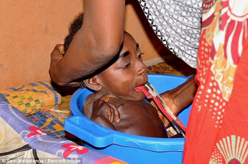 La niña de la cuenca: la historia de una mujer nigeriana con la cabeza de una mujer adulta y el cuerpo de un bebé