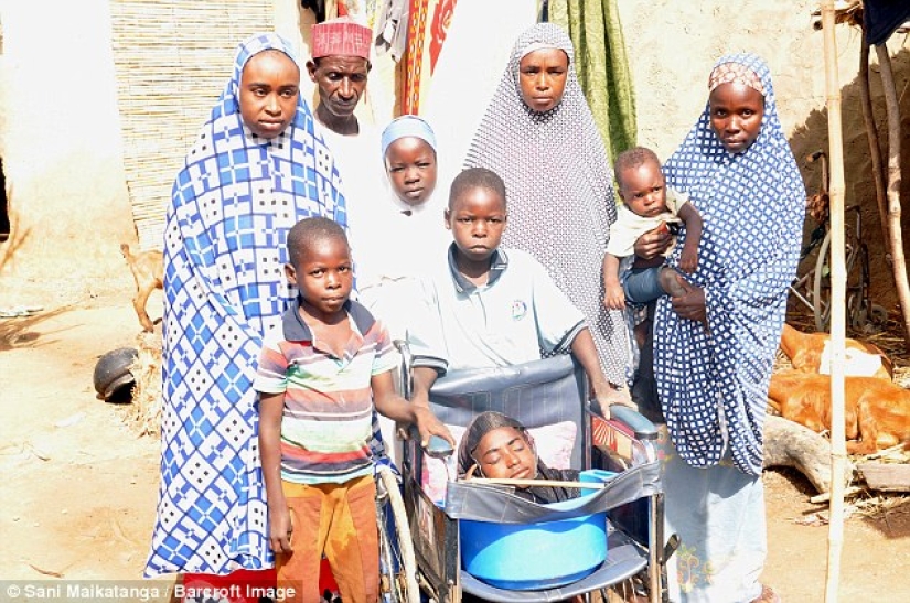 La niña de la cuenca: la historia de una mujer nigeriana con la cabeza de una mujer adulta y el cuerpo de un bebé
