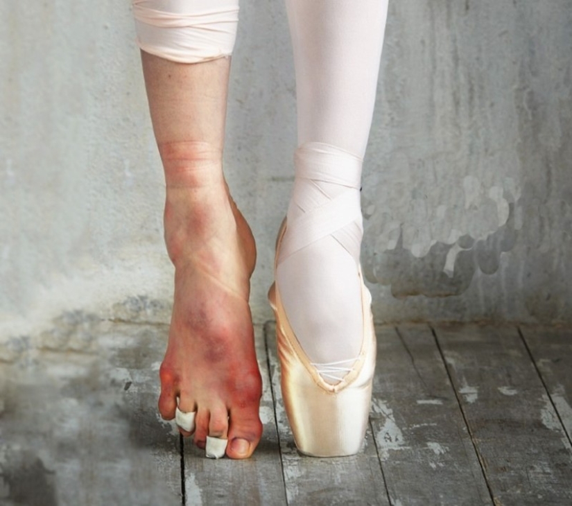 La otra cara del éxito: el precio de la perfección