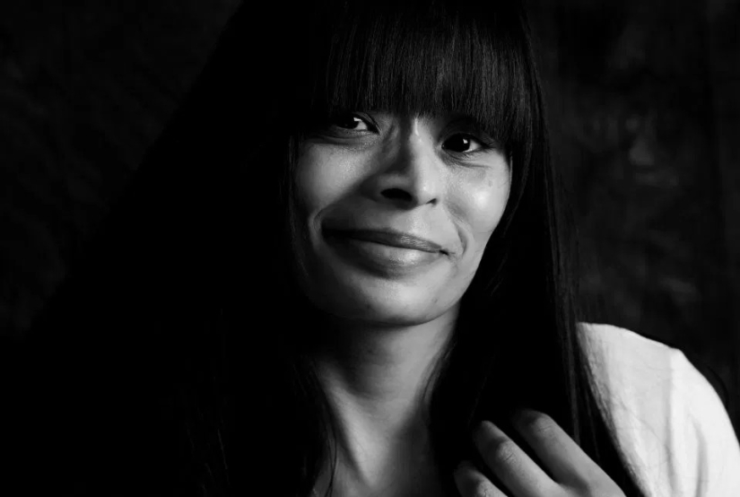 La verdad desnuda: Pacientes valientes se enfrentan al cáncer mostrando cicatrices en el conmovedor proyecto fotográfico de Ami Barwell