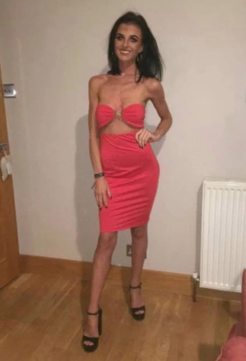 Life-saving booze: vacation with friends at the resort saved the girl from anorexia