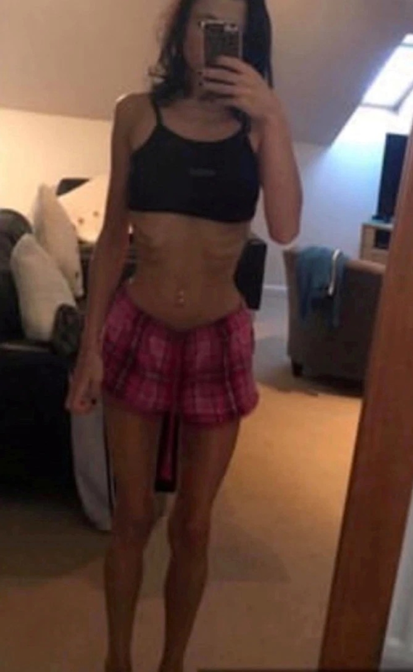 Life-saving booze: vacation with friends at the resort saved the girl from anorexia