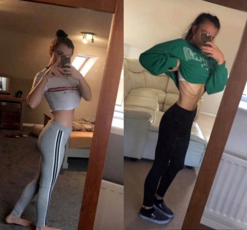 Life-saving booze: vacation with friends at the resort saved the girl from anorexia