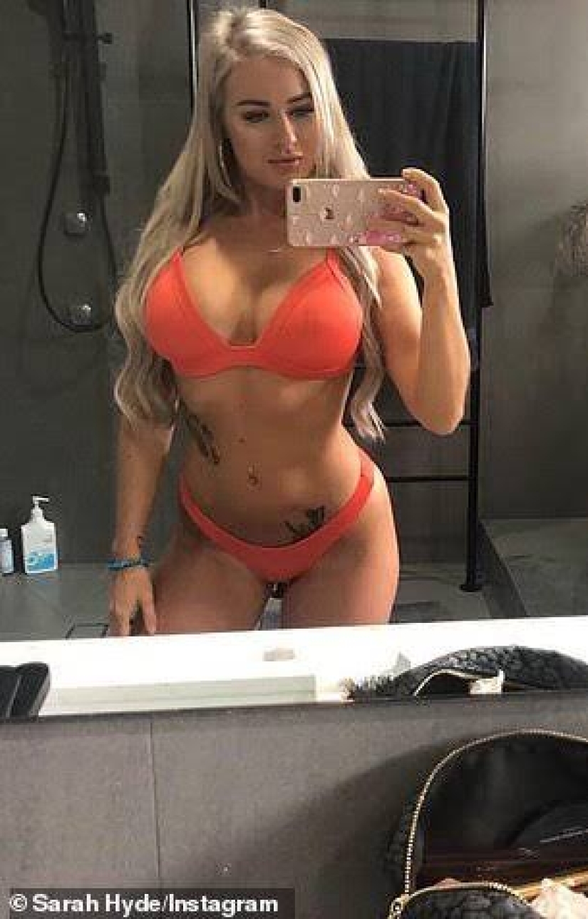 Like a stone from the soul: an Australian woman removed silicone from her breasts because it interfered with her sex life