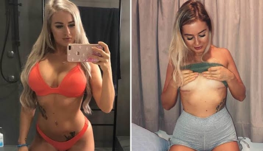 Like a stone from the soul: an Australian woman removed silicone from her breasts because it interfered with her sex life