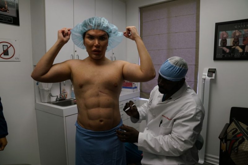 "Living Ken" se dio cuenta de que era una Barbie y ahora iba a cambiar de género