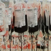 Los 8 errores médicos más impactantes que cometen