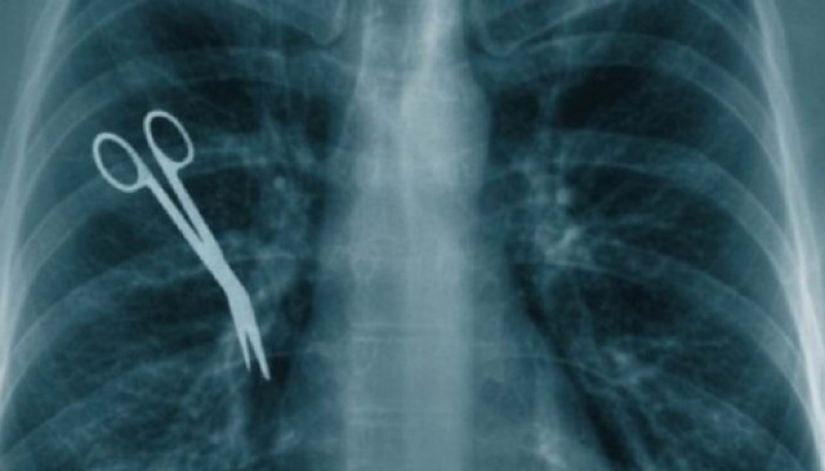 Los 8 errores médicos más impactantes que cometen