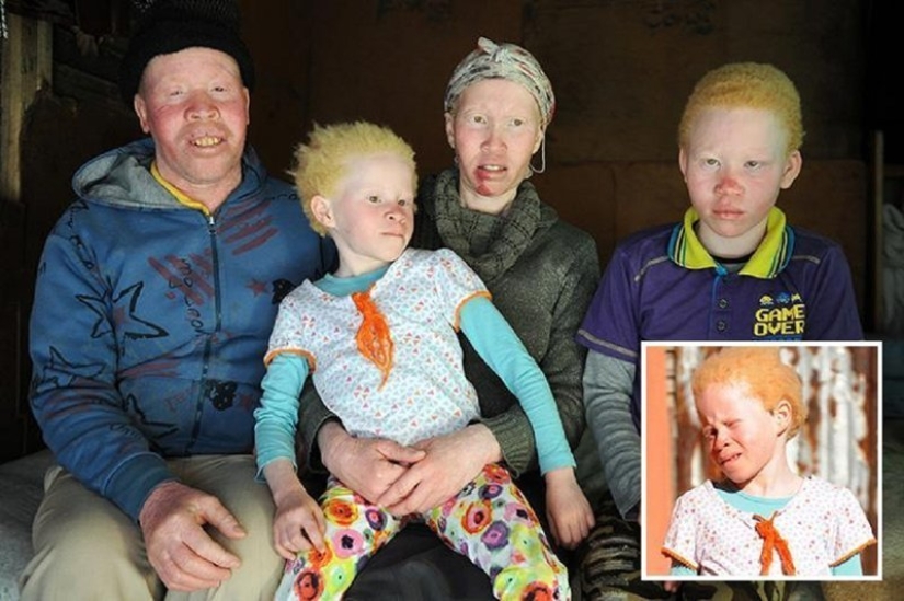 Los albinos africanos no ocultan sus miedos