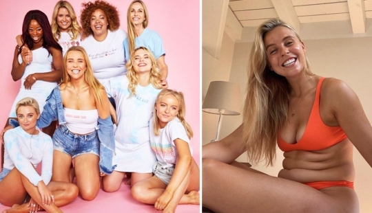 Love for the world begins with herself: she has a tumor on her face since birth, but she has learned to accept her appearance