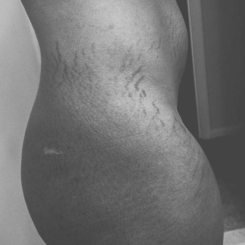 Love your stretch marks Love your stretch marks
