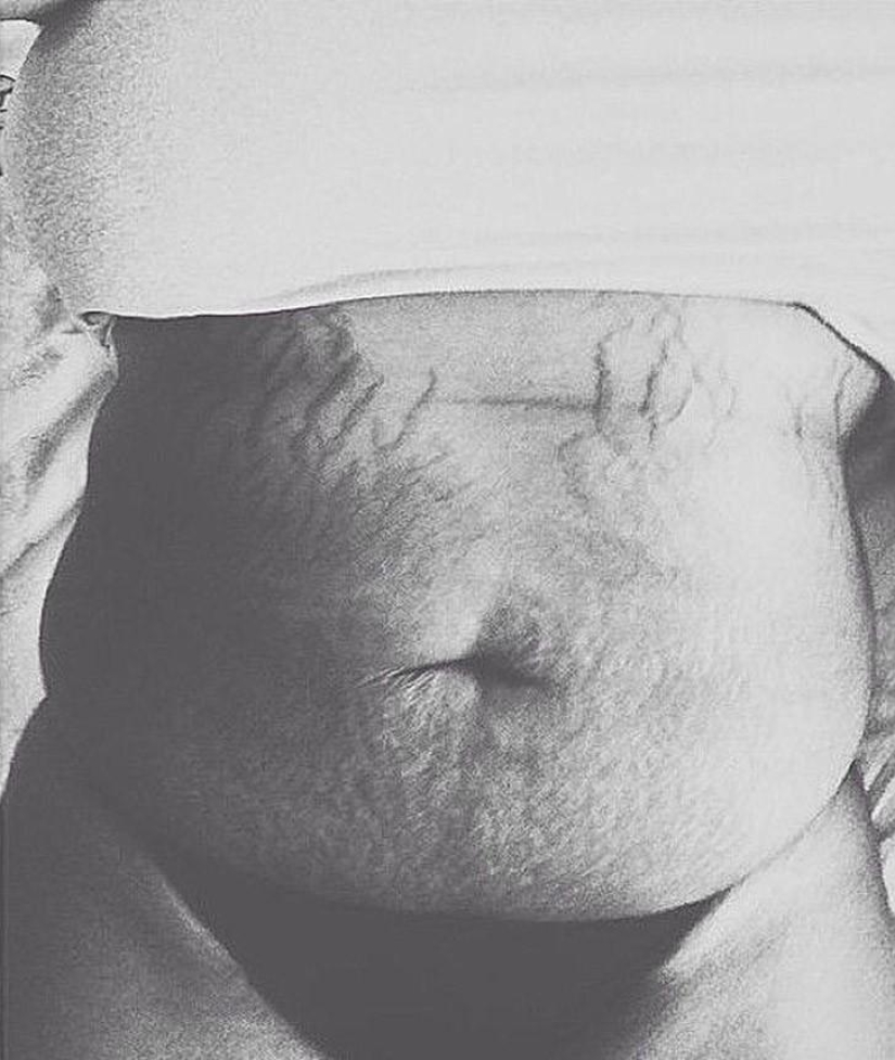 Love your stretch marks Love your stretch marks