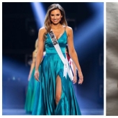 Manicura mortal: la reina de belleza fue diagnosticada con cáncer después de las extensiones de uñas