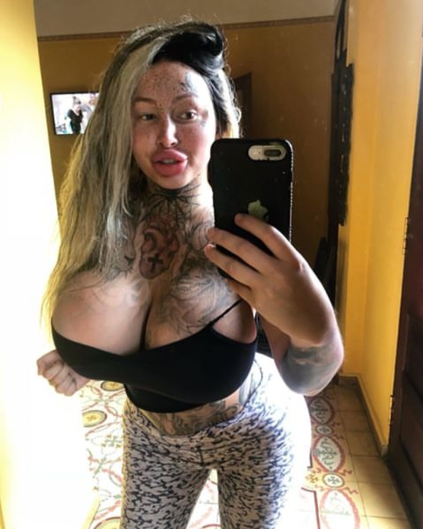 Modelo fetichista casi muere durante una cirugía plástica en su vagina