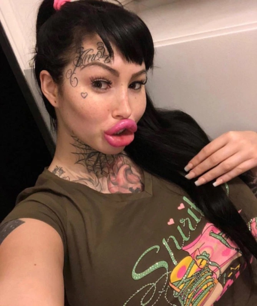 Modelo fetichista casi muere durante una cirugía plástica en su vagina