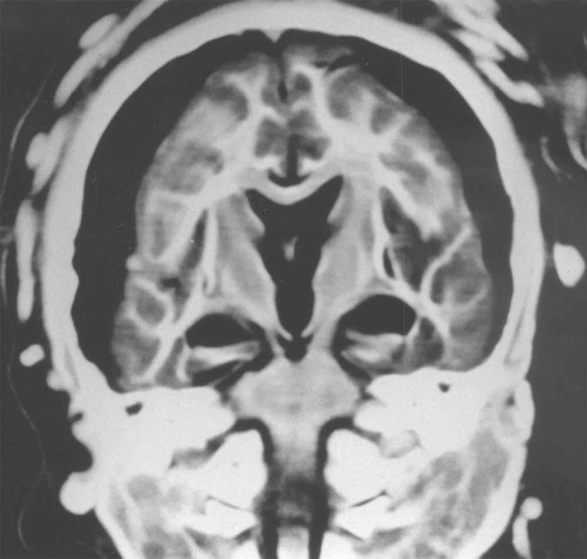 Momias incas de niños y mujeres sacrificados