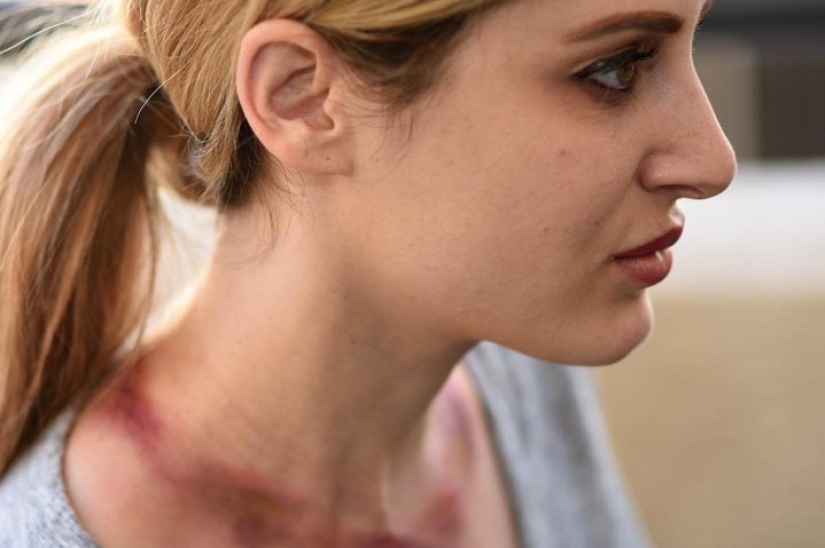 "Mujer jirafa" : una mujer estadounidense estiró su cuello durante 5 años para volverse como una jirafa "Mujer jirafa" : una mujer estadounidense estiró su cuello durante 5 años para volverse como una jirafa