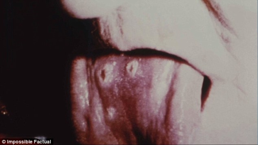 Murió de viruela en 1851: se establece la identidad de la niña enterrada en un ataúd de hierro en Nueva York Murió de viruela en 1851: se establece la identidad de la niña enterrada en un ataúd de hierro en Nueva York