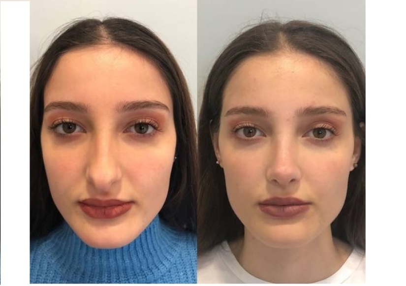 Niñas antes y después de un solo cambio de apariencia