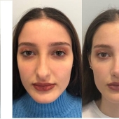 Niñas antes y después de un solo cambio de apariencia