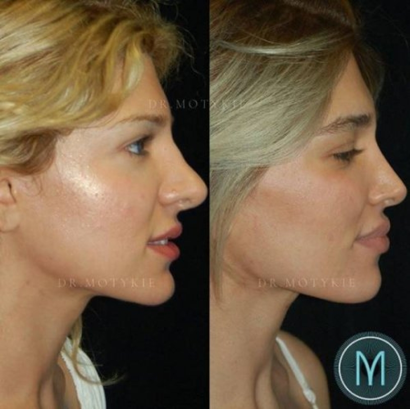 Niñas antes y después de un solo cambio de apariencia Niñas antes y después de un solo cambio de apariencia